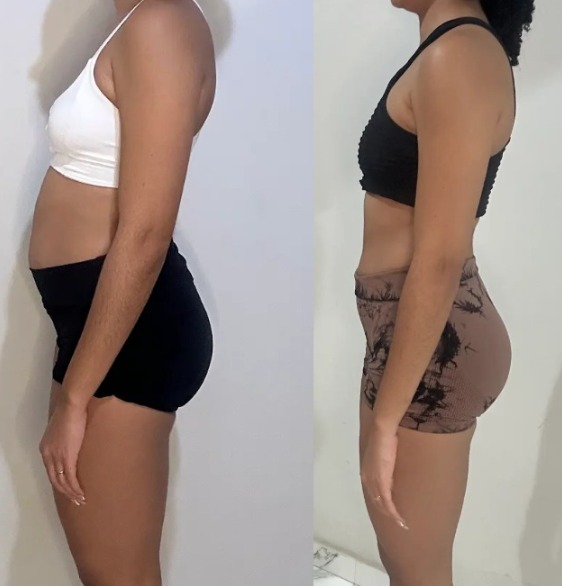 Resultado Seca Bucho